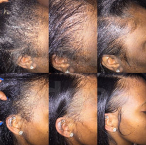 3 Fab Product Combinations That Keep My Edges Laid and Slayed