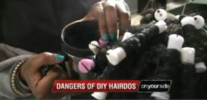 News Channel Warning on DIY Hair Care Trend after a Little Girl Receives Second Degree Burns