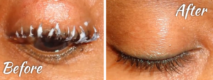 Putting Relaxer On Your Eyelashes?
