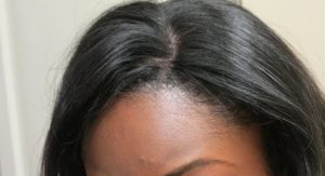 Blend Natural Roots with Lace Closure