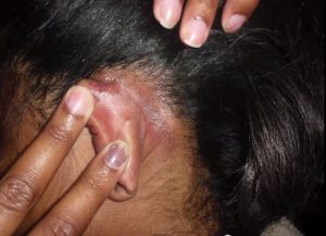 The Harmful Effects Of Relaxers - A Critical Look And My Own Experience