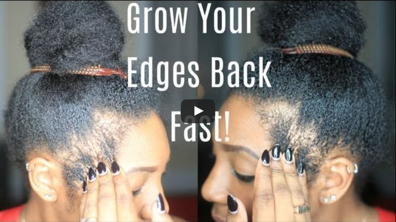 grow-out-your-edges-bald-spots-fast