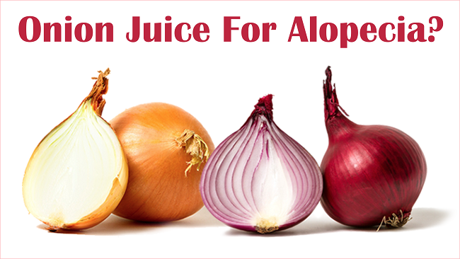 Onion juice for alopecia