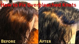 How To Fix Over Bleached Knots On Your Lace Closure/Frontal | Diy Frontal Customization