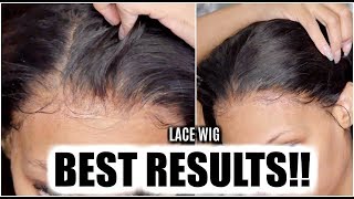 Step By Step Lace Wig Knot Bleaching Tutorial!! (Beginner Friendly)