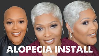 White Short Hair On My Alopecia Lace Install/Make A Large Wig Small #Shorthaircut #Boldhold