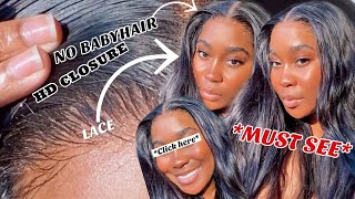 This Is Scalp!  | No Babyhair Melt *Must See* | Hd Lace 5X5 Closure Wig Install | Ft Unice Hair