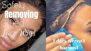 How To Safely Remove Ghost Bond Glued 360 Lace Wig, ( No Rip Edges) | Under 3 Mins