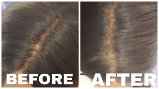How To "Bleach" Knots On A Synthetic Wig