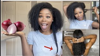 2 Ways To Use Onion Juice For Massive Hair Growth | How To Use Onions For Extreme Hair Growth