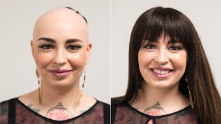 Real Hair Wig Instead Of Baldness | Help With Alopecia Areata | Hairsystems Heydecke
