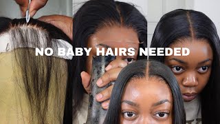 No Baby Hair Glueless Closure Wig Install Ft Tinashe Hair