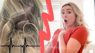 Tape In Hair Extension Horror Story! ( Help )