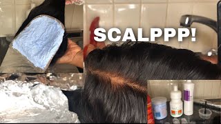 How To Bleach Knots Easily On Lace Closure/Frontal Using Home Tools | Fail Proof | Beginner Friendly