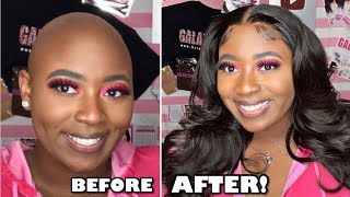 Let’S Talk Alopecia | 5X5 Lace Closure Wig Install Ft. Royal Me