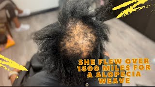 She Flew Over 1800 Miles For A Alopecia Weaving Transformation | How To Safely Cover A Bald Spot
