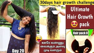 Every Week Use This Hair Packget Ultimate Results | Baldness Control Pack @Jegathees Meena