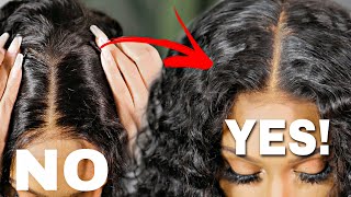 Wow Real Scalp!! How To Hide Lace On Wigs!  #Whatlace