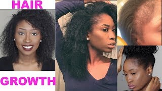How I Grew My Hair & Bald Edges Back! Natural Hair Length Check & Products!