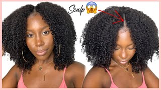 It'S My Scalp! 4C Natural Curls I Part Wig | Ilikehaircom