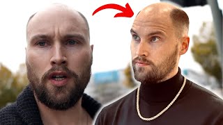 Bald Man Haircut - How I Really Feel About It