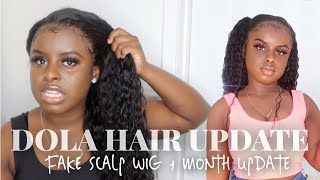 Dola Hair Fake Scalp Wig | Install Update  Curly Hair