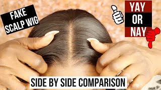 Let'S Settle The Fake Scalp Debate! Is It Really Needed? Ft Myfirstwig
