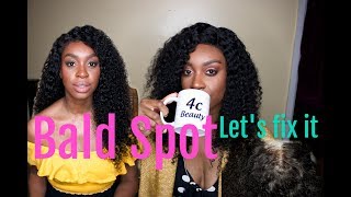 How To Fix A Bald Spot On You Lace Closure| Most Affordable ($66) Curly Hair Bundles| Ft. West Kiss