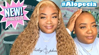 Suffering From Alopecia | Honey Blonde Wig Install Ft. Yolissa Hair!