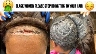 Must Watch! Black Women & Hair Damage| Natural Hair Horror Story | A Rant