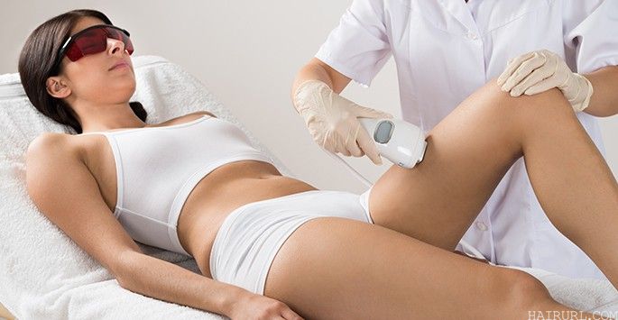 Laser Hair Body Hair Removal Technique