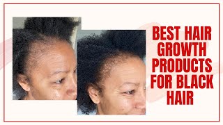 Best Hair Growth Products For Black Women Over 40 Update | Time With Natalie