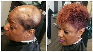 Hair Unit Transformation For Women | Alopecia Client | Cut By Kani Gordon
