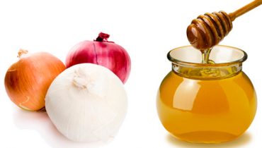 Onion vs. Honey: Home Remedies for Hair Growth