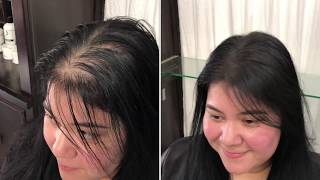 Hair Cubed Simple And Easy To Use Women'S Thinning Hair- Try It -If You Are Having Thinning Hai
