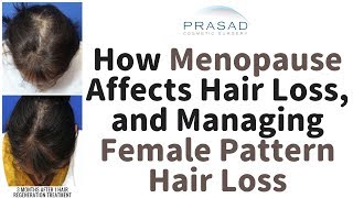 How Pattern Hair Loss Increases In Women Over 50, And How Menopause Can Affect Hair