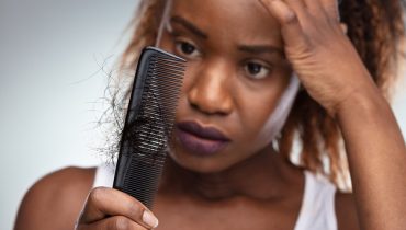Do Hair Relaxers Really Cause Hair Loss?