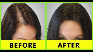 How To Grow Hair On Forehead Hair Growth Tips For Forehead Tamil Beauty Tips