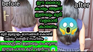 Fast Hair Growth Secret Tips|This Is  Genuine Result||World'S First Fast Hair Growth Tips