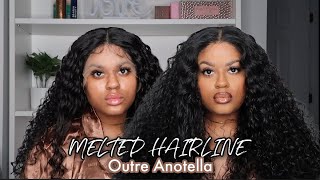 *New* Outre Melted Hairline Antonella | Hd Lace Under $40! Courtney Jinean