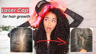 Trying The Kiierr Laser Cap For Hair Growth  Hair Growth Tips & Advice