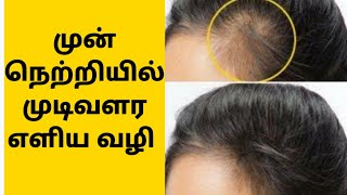 Front Hair Growth Tips In Tamil