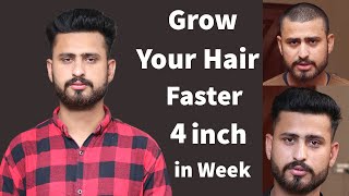 How To Grow Your Hair Faster And Longer Naturally At Home | Grow Your Hair Fast 4 Inch In A Week