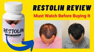 Restolin Review | Restolin Hair Review | Does It Really Work? | Restolin Hair Growth Reviews