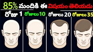 20 వయస్సు Must Watch || Natural Hair Growth Tips || Time For Greatness Telugu