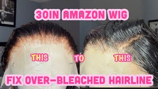 *Detailed* Fix Your Over Bleached Knots| Must Have Affordable 30Inch Amazon Wig! | Samone Emon