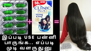 Fast Hair Growth Tips In Tamil / Evion 400 For Hair Growth
