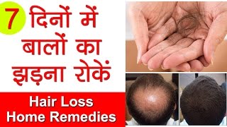 How To Stop Hair Fall, Cure Hair Loss & Grow Long Hair | Ganjepan Ka Ilaaj With Onion Home Remedies