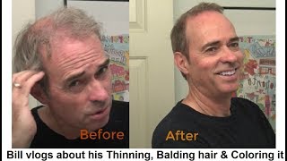 Bill Vlogs About His Thinning, Balding Hair & His Cut & Color/ Style, Men Over 50