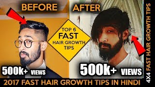 2017 Top 6 Fast Hair Growth Tips In Hindi | Homemade Method | Faster  Hair Growth Tips